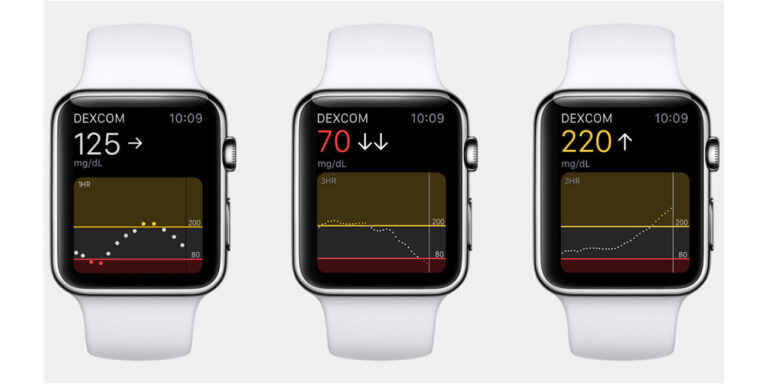 Apple Watch Glucose Monitor Release Date